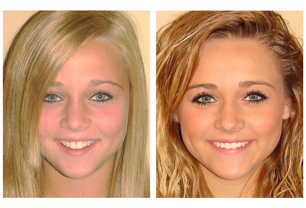 Thomas   Dragonette DDS